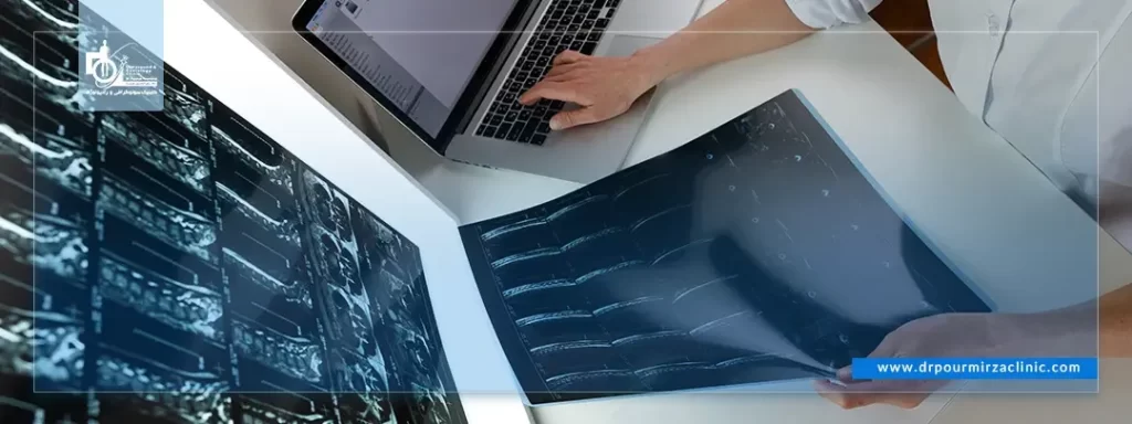 اینترونشن در ایلام